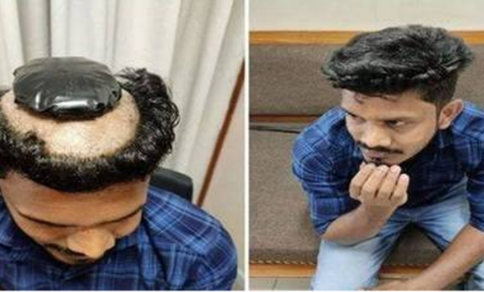 পরচুলার ভেতরে থেকে ১.১৩ কেজির সোনা উদ্ধার